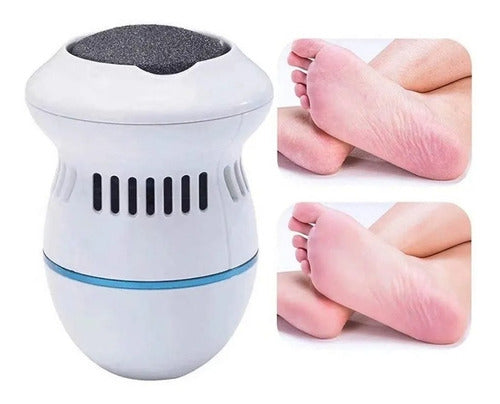 REMOVEDOR DE CALLOS ELECTRICO PARA PIES ⭐⭐⭐⭐⭐