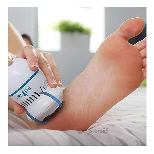 REMOVEDOR DE CALLOS ELECTRICO PARA PIES ⭐⭐⭐⭐⭐