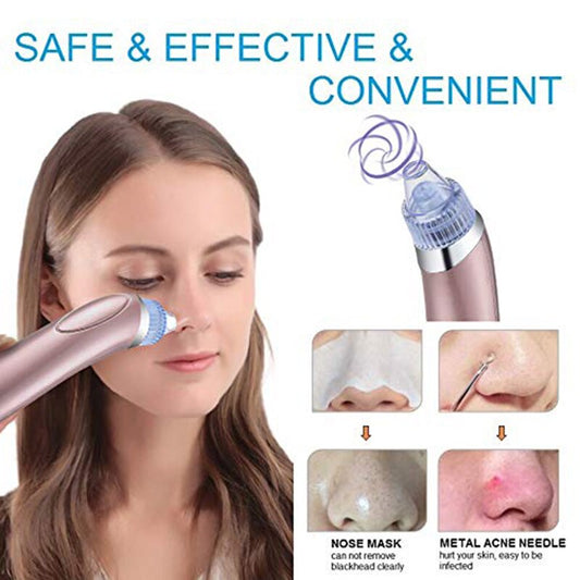 Removedor de Espinillas Electrico ⭐⭐⭐⭐⭐